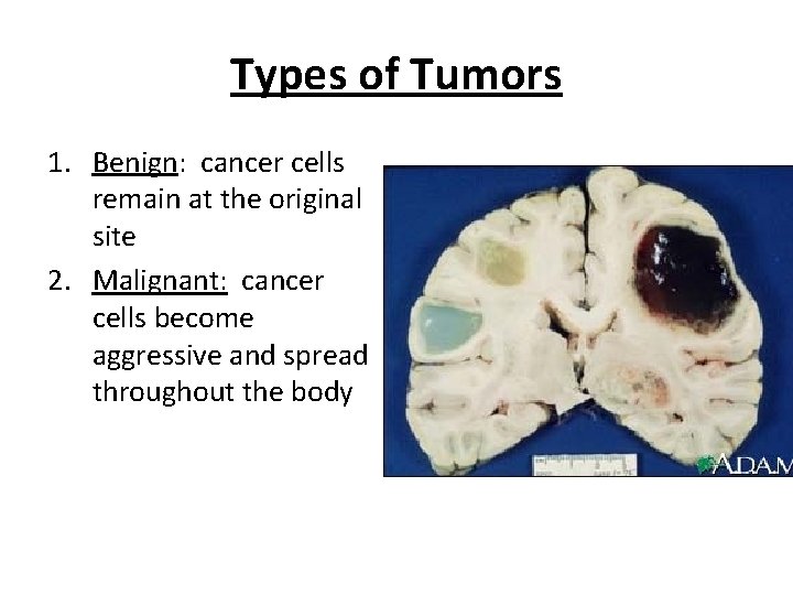 Types of Tumors 1. Benign: cancer cells remain at the original site 2. Malignant: