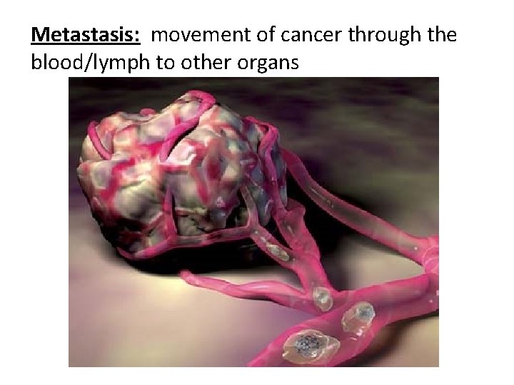 Metastasis: movement of cancer through the blood/lymph to other organs 