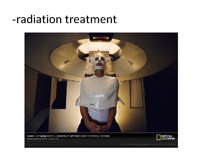 -radiation treatment 