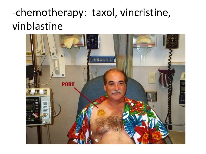 -chemotherapy: taxol, vincristine, vinblastine 