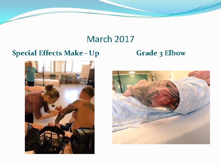 March 2017 Special Effects Make - Up Grade 3 Elbow 