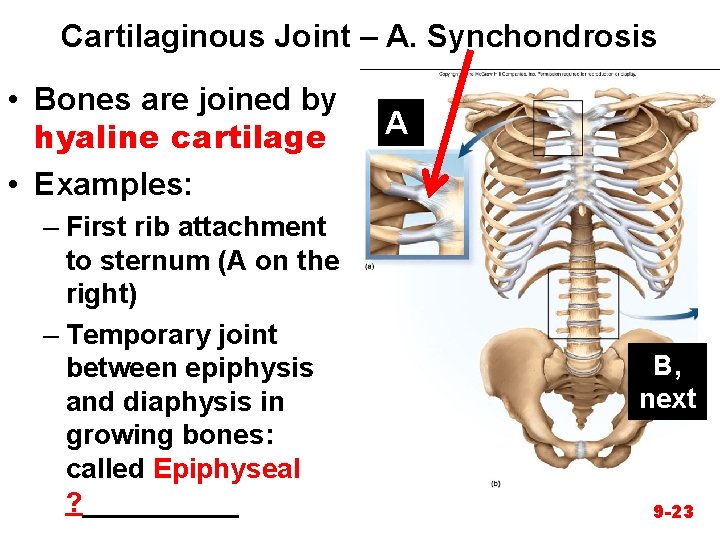 Cartilaginous Joint – A. Synchondrosis • Bones are joined by hyaline cartilage • Examples: Cartilaginous Joint – A. Synchondrosis • Bones are joined by hyaline cartilage • Examples: