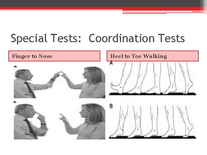 Special Tests: Coordination Tests Finger to Nose Heel to Toe Walking 