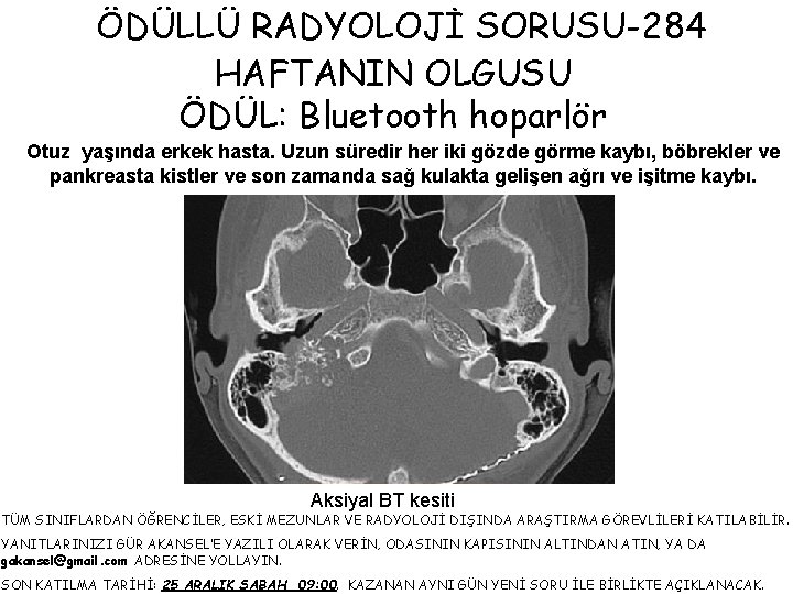ÖDÜLLÜ RADYOLOJİ SORUSU-284 HAFTANIN OLGUSU ÖDÜL: Bluetooth hoparlör Otuz yaşında erkek hasta. Uzun süredir