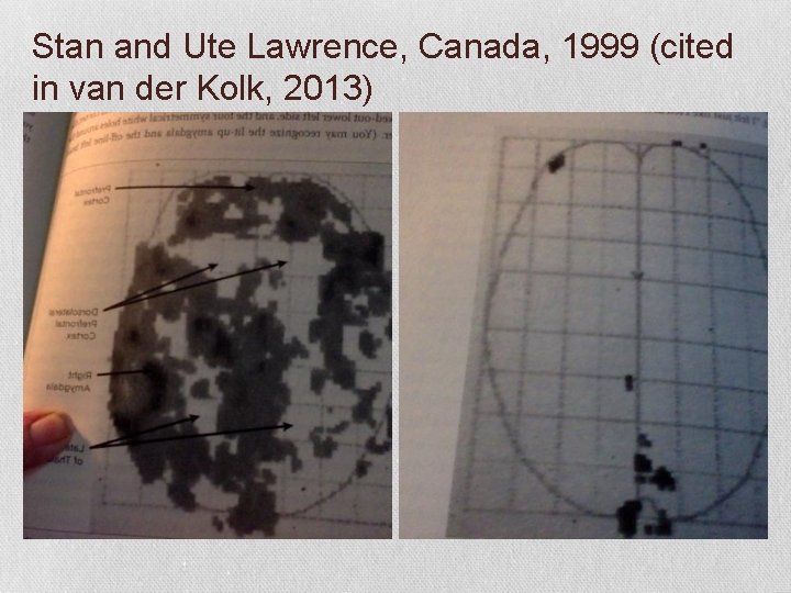 Stan and Ute Lawrence, Canada, 1999 (cited in van der Kolk, 2013) 