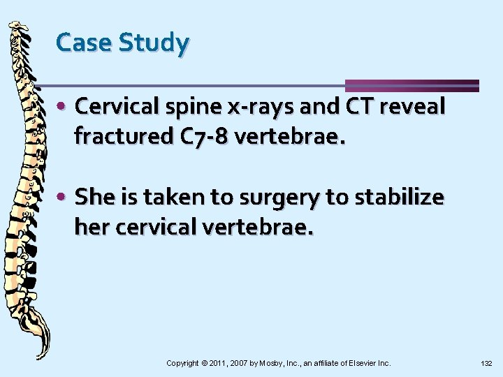 Case Study • Cervical spine x-rays and CT reveal fractured C 7 -8 vertebrae.