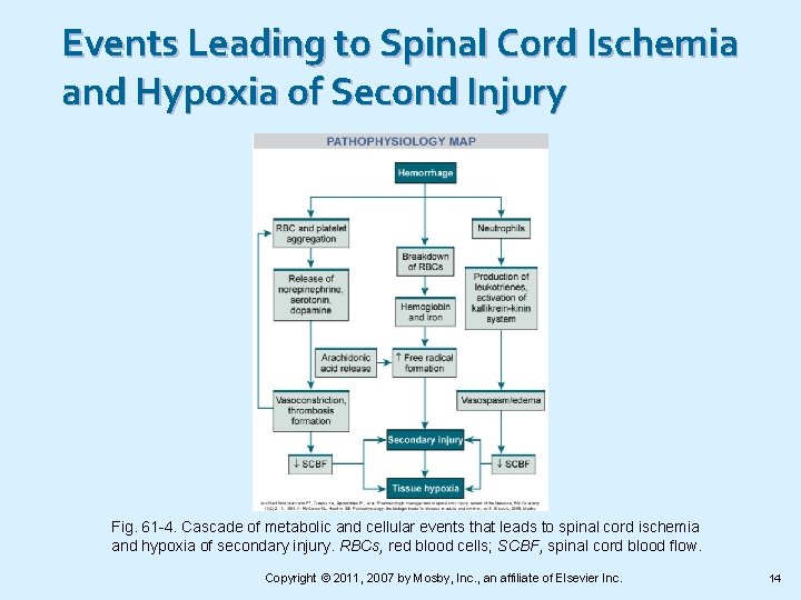 Events Leading to Spinal Cord Ischemia and Hypoxia of Second Injury Fig. 61 -4.