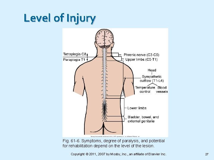 Level of Injury Fig. 61 -6. Symptoms, degree of paralysis, and potential for rehabilitation
