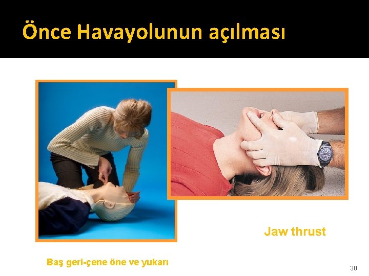 Önce Havayolunun açılması Jaw thrust Baş geri-çene öne ve yukarı 30 Önce Havayolunun açılması Jaw thrust Baş geri-çene öne ve yukarı 30