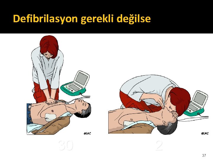 Defibrilasyon gerekli değilse 30 2 37 Defibrilasyon gerekli değilse 30 2 37