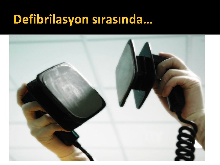 Defibrilasyon sırasında… Elektrotları birbirine sürerek jellemeyiniz! Ambu/ventilatörü endotrakeal tüpten ayırınız! Oksijen kaynağını mümkünse kapatınız! Defibrilasyon sırasında… Elektrotları birbirine sürerek jellemeyiniz! Ambu/ventilatörü endotrakeal tüpten ayırınız! Oksijen kaynağını mümkünse kapatınız!