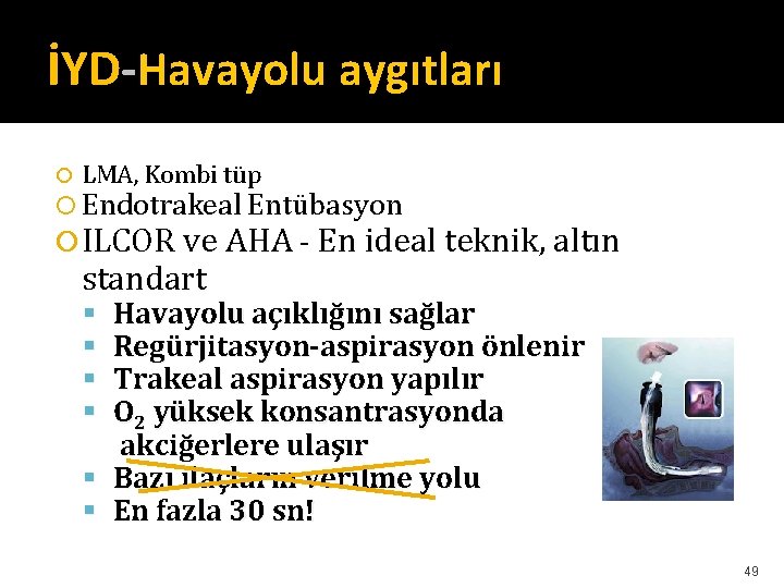 İYD-Havayolu aygıtları LMA, Kombi tüp Endotrakeal Entübasyon ILCOR ve AHA - En ideal teknik, İYD-Havayolu aygıtları LMA, Kombi tüp Endotrakeal Entübasyon ILCOR ve AHA - En ideal teknik,