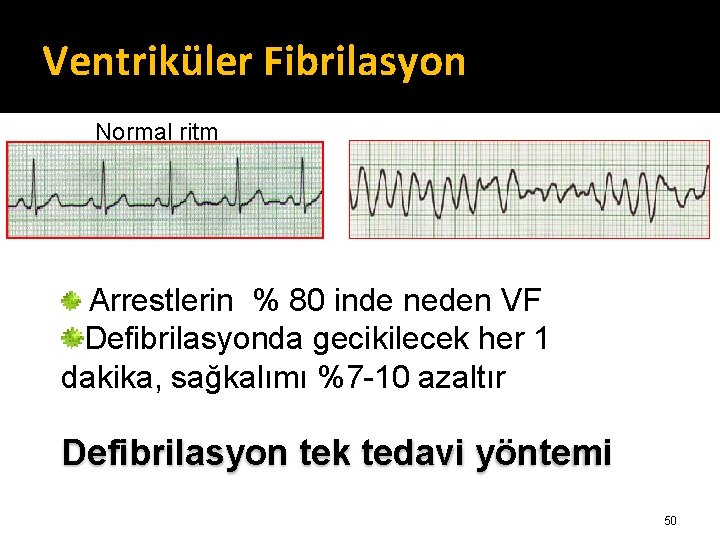 Ventriküler Fibrilasyon Normal ritm Arrestlerin % 80 inde neden VF Defibrilasyonda gecikilecek her 1 Ventriküler Fibrilasyon Normal ritm Arrestlerin % 80 inde neden VF Defibrilasyonda gecikilecek her 1