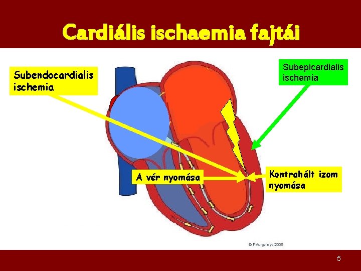 reverzibilis ischaemia szív egészsége