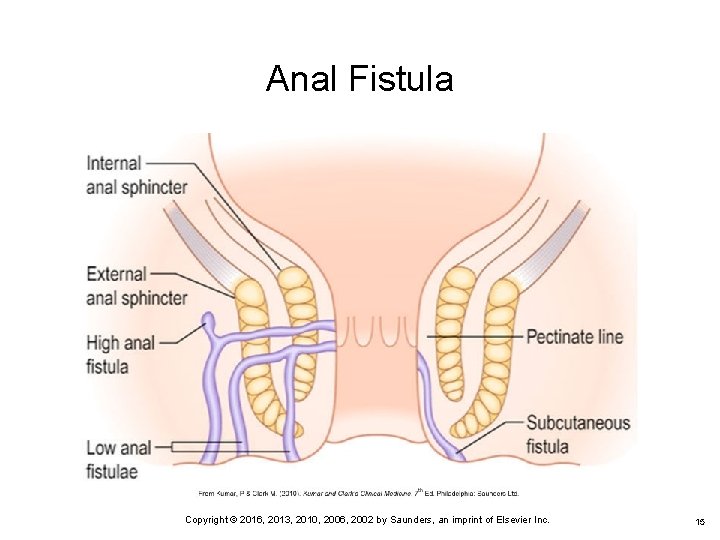 Chapter 57 Care of Patients with Inflammatory Intestinal
