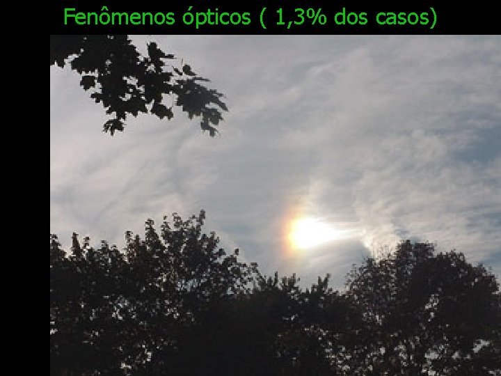 Fenômenos ópticos ( 1, 3% dos casos) 