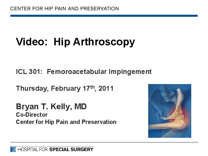 Video: Hip Arthroscopy ICL 301: Femoroacetabular Impingement Thursday, February 17 th, 2011 Bryan T.