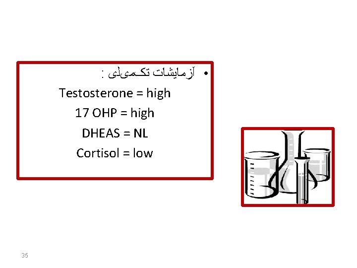 : • آﺰﻣﺎﻳﺸﺎﺕ ﺗکﻤیﻠی Testosterone = high 17 OHP = high DHEAS = NL