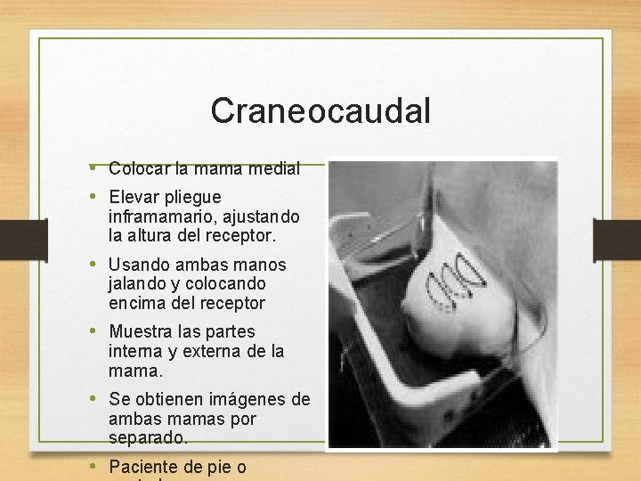Craneocaudal • Colocar la mama medial • Elevar pliegue inframamario, ajustando la altura del