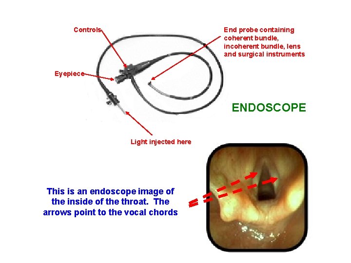 End probe containing coherent bundle, incoherent bundle, lens and surgical instruments Controls Eyepiece ENDOSCOPE