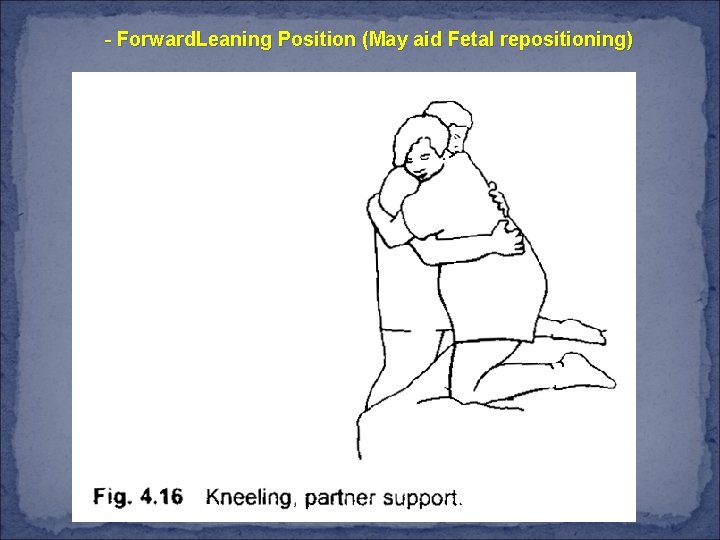 - Forward. Leaning Position (May aid Fetal repositioning) 