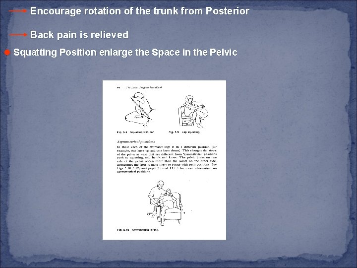 Encourage rotation of the trunk from Posterior Back pain is relieved l Squatting Position