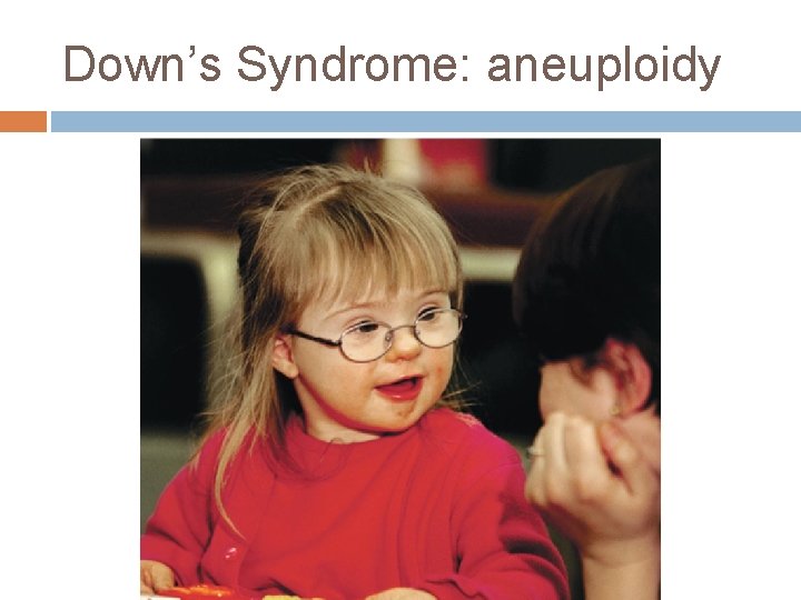 Down’s Syndrome: aneuploidy 