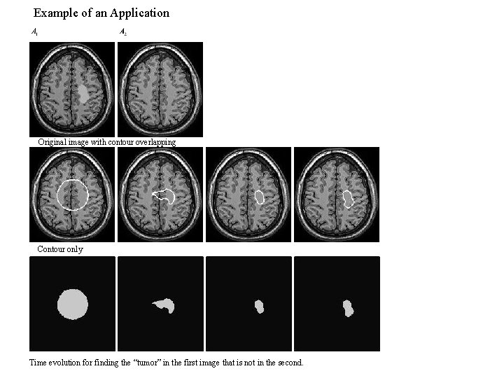 Example of an Application Original image with contour overlapping Contour only Time evolution for