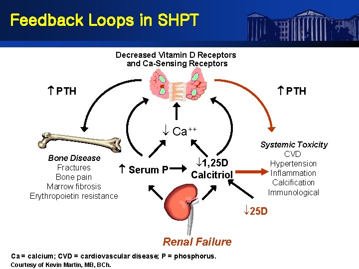 Feedback Loops in SHPT Decreased Vitamin D Receptors and Ca-Sensing Receptors PTH Ca++ Bone