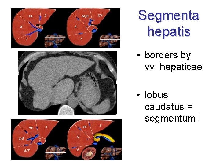Segmenta hepatis • borders by vv. hepaticae • lobus caudatus = segmentum I 