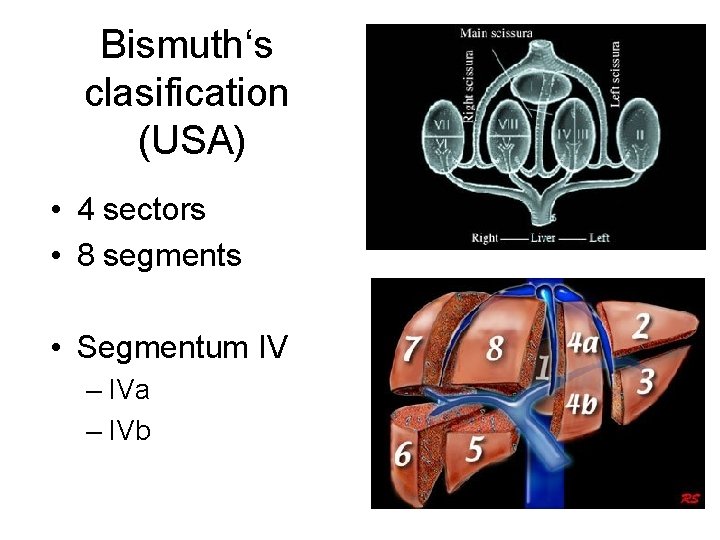 Bismuth‘s clasification (USA) • 4 sectors • 8 segments • Segmentum IV – IVa