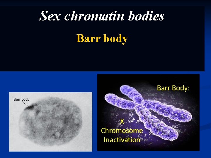 Sex chromatin bodies Barr body 