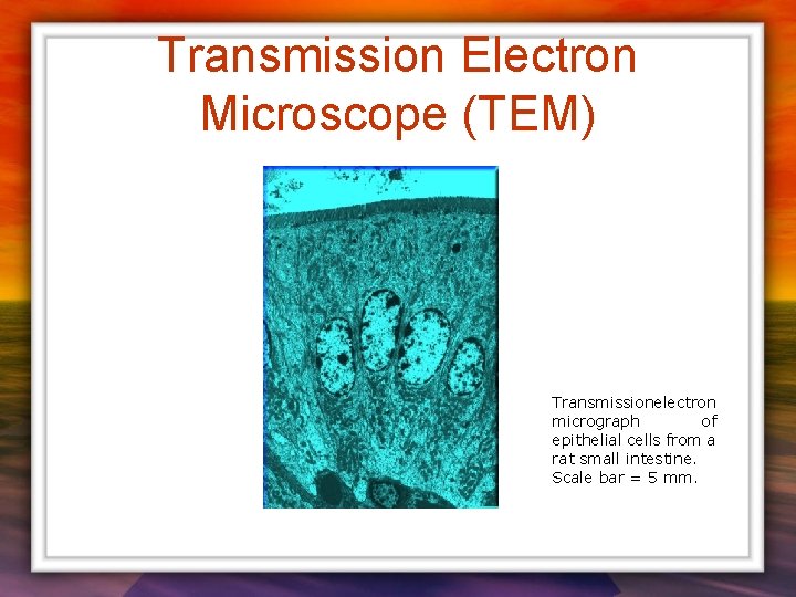 Transmission Electron Microscope (TEM) Transmissionelectron micrograph of epithelial cells from a rat small intestine.