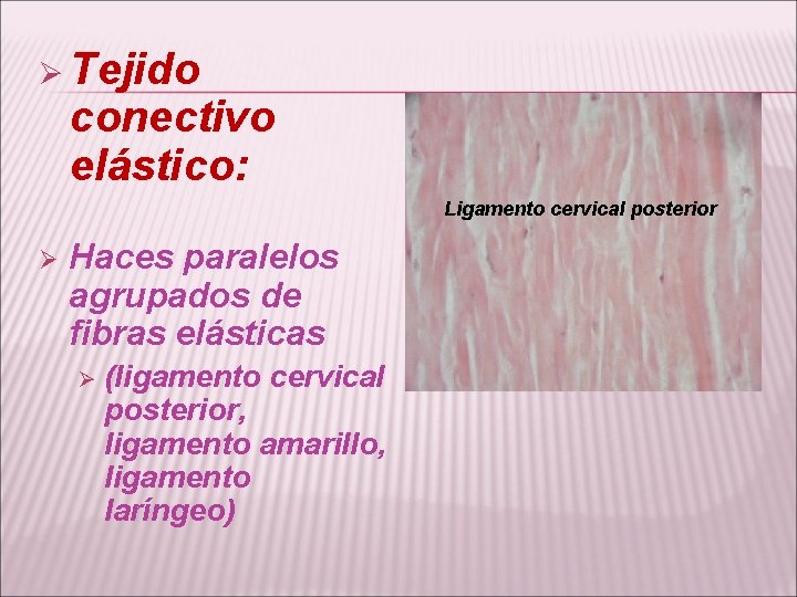 Ø Tejido conectivo elástico: Ligamento cervical posterior Ø Haces paralelos agrupados de fibras elásticas