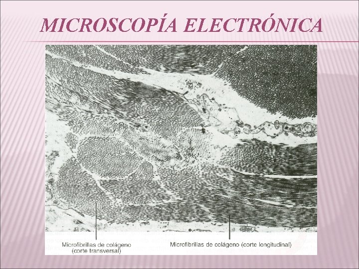 MICROSCOPÍA ELECTRÓNICA 