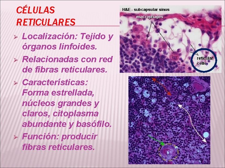 CÉLULAS RETICULARES Ø Ø Localización: Tejido y órganos linfoides. Relacionadas con red de fibras