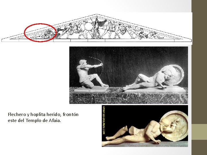 Flechero y hoplita herido, frontón este del Templo de Afaia. 