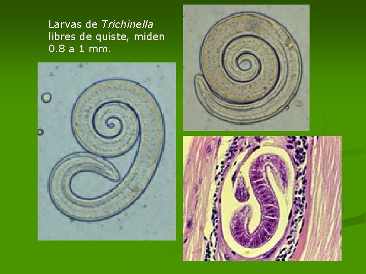 Larvas de Trichinella libres de quiste, miden 0. 8 a 1 mm. Larvas de Trichinella libres de quiste, miden 0. 8 a 1 mm.