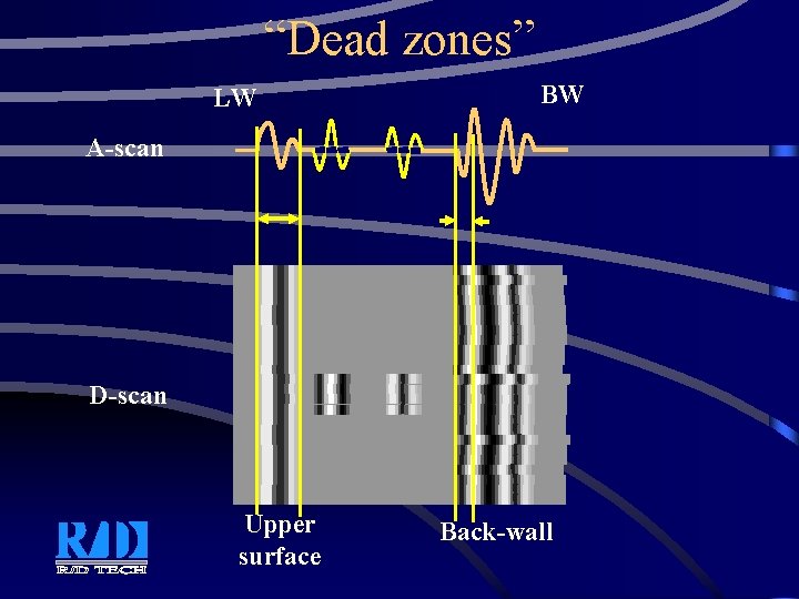 “Dead zones” LW BW A-scan D-scan Upper surface Back-wall 