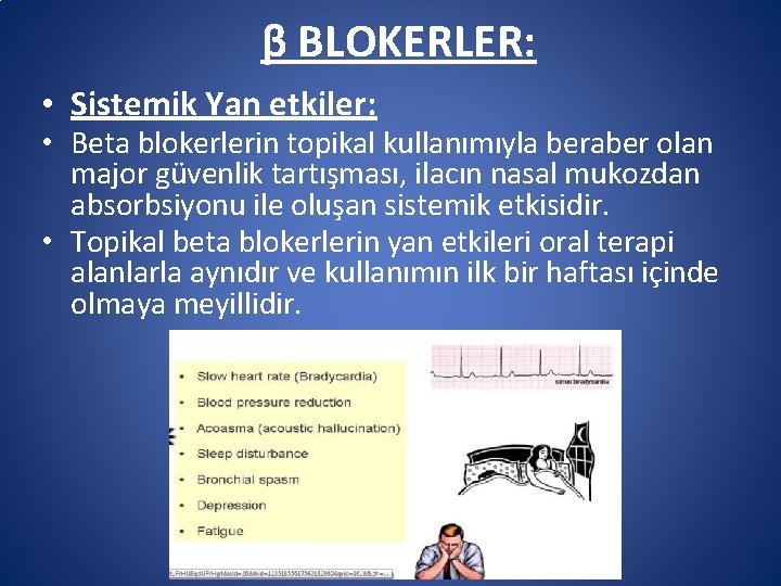 β BLOKERLER: • Sistemik Yan etkiler: • Beta blokerlerin topikal kullanımıyla beraber olan major