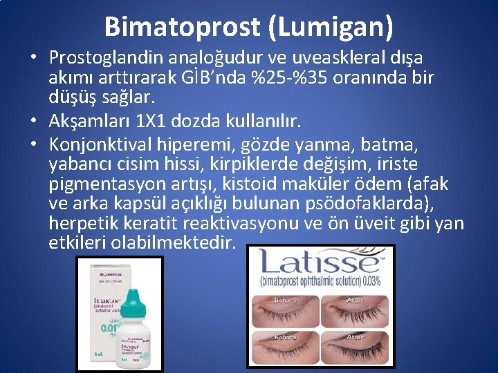 Bimatoprost (Lumigan) • Prostoglandin analoğudur ve uveaskleral dışa akımı arttırarak GİB’nda %25 -%35 oranında