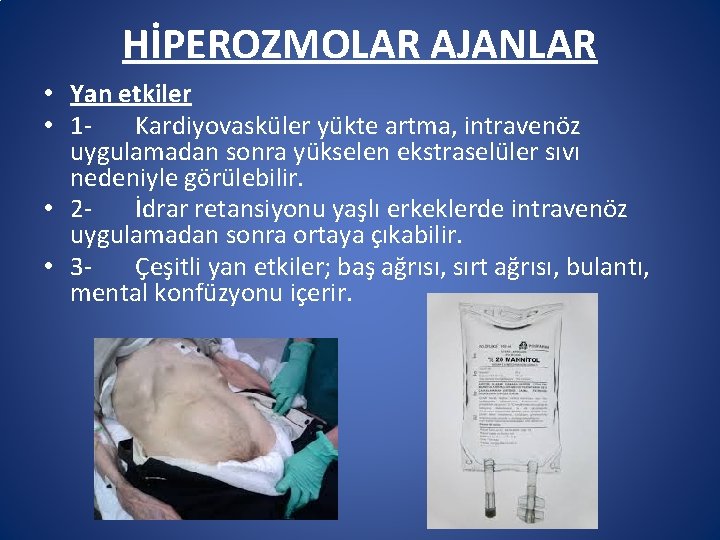 HİPEROZMOLAR AJANLAR • Yan etkiler • 1 - Kardiyovasküler yükte artma, intravenöz uygulamadan sonra