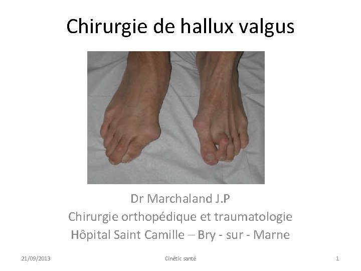 Chirurgie de hallux valgus Dr Marchaland J. P Chirurgie orthopédique et traumatologie Hôpital Saint