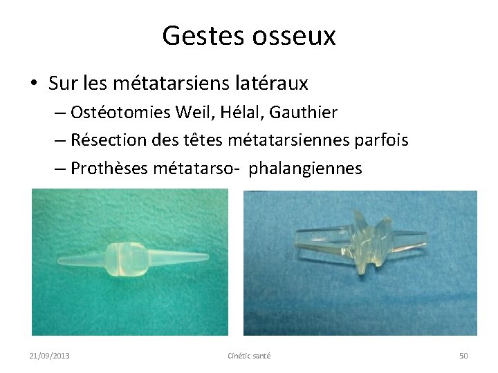 Gestes osseux • Sur les métatarsiens latéraux – Ostéotomies Weil, Hélal, Gauthier – Résection