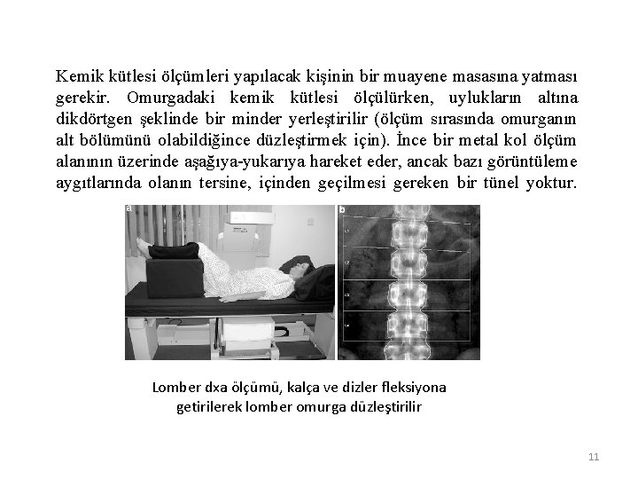 Kemik kütlesi ölçümleri yapılacak kişinin bir muayene masasına yatması gerekir. Omurgadaki kemik kütlesi ölçülürken,