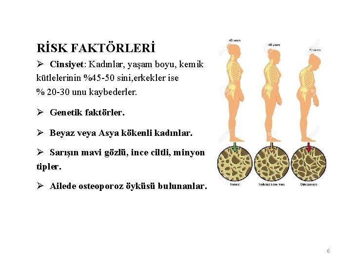 RİSK FAKTÖRLERİ Ø Cinsiyet: Kadınlar, yaşam boyu, kemik kütlelerinin %45 -50 sini, erkekler ise