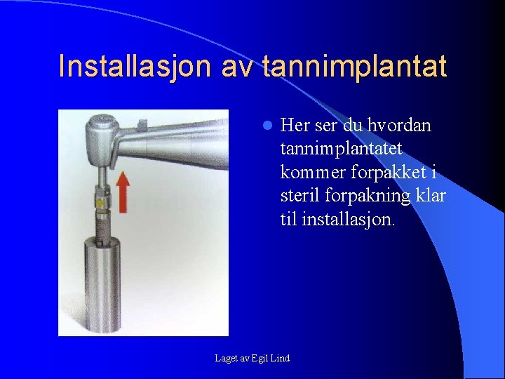 Installasjon av tannimplantat l Her ser du hvordan tannimplantatet kommer forpakket i steril forpakning Installasjon av tannimplantat l Her ser du hvordan tannimplantatet kommer forpakket i steril forpakning