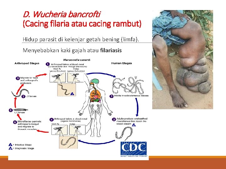 D. Wucheria bancrofti (Cacing filaria atau cacing rambut) Hidup parasit di kelenjar getah bening