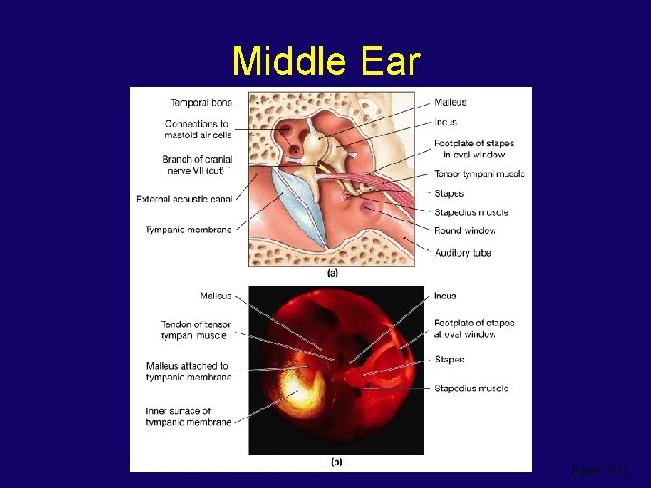 Middle Ear Figure 17. 21 