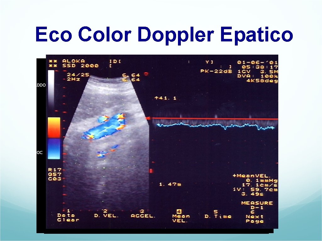 Eco Color Doppler Epatico 